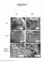 Fig. 03 - Materials and methods for preventing and treating anastomotic leaks