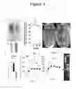 Fig. 04 - Materials and methods for preventing and treating anastomotic leaks