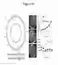Fig. 07 - Materials and methods for preventing and treating anastomotic leaks