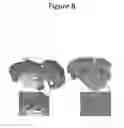Fig. 09 - Materials and methods for preventing and treating anastomotic leaks
