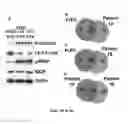 Fig. 06 - TREATING CANCER