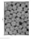 Fig. 02 - Biodegradable microbead comprising anionic polymer for improving adsorptive power to anticancer drugs, and method for preparing same