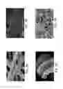Fig. 07 - Composition, preparation, and use of chitosan shards for biomedical applications