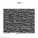 Fig. 06 - Multilayer Fibrous Polymer Scaffolds, Methods of Production and Methods of Use