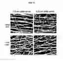 Fig. 11 - Multilayer Fibrous Polymer Scaffolds, Methods of Production and Methods of Use