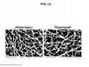Fig. 12 - Multilayer Fibrous Polymer Scaffolds, Methods of Production and Methods of Use