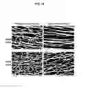 Fig. 14 - Multilayer Fibrous Polymer Scaffolds, Methods of Production and Methods of Use