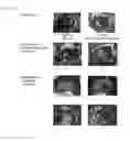 Fig. 04 - CARRIER FOR TRANSFERRING CELL SHEET FOR TRANSPLANTATION