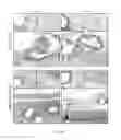 Fig. 06 - Extracellular matrix mesh coating