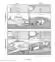 Fig. 08 - Extracellular matrix mesh coating
