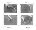 Fig. 04 - Methods and compositions for the treatment of open and closed wound spinal cord injuries
