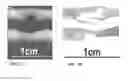 Fig. 08 - Methods and compositions for the treatment of open and closed wound spinal cord injuries