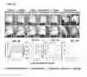 Fig. 09 - Methods and compositions for the treatment of open and closed wound spinal cord injuries