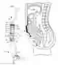 Fig. 01 - Implantable bioartificial perfusion system