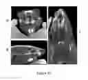 Fig. 34 - Nasal delivery device