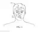 Fig. 02 - Intranasal medication delivery device and method of use thereof
