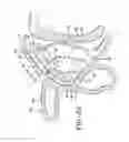 Fig. 07 - Intranasal medication delivery device and method of use thereof