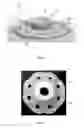 Fig. 02 - PERCUTANEOUS TUBE STABILIZATION DEVICE