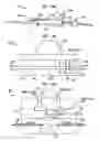 Fig. 09 - Systems and methods for shunting fluid