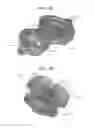Fig. 35 - Systems and methods for shunting fluid