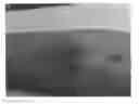 Fig. 01 - Ultrasonic dispersion of compositions in tissue