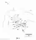 Fig. 02 - Systems and methods for leadless pacing and shock therapy