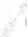 Fig. 02 - Weight bar T-handle and pivot anchor assembly