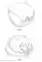 Fig. 02 - Golf club having removeable weight