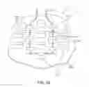 Fig. 19 - Article of apparel with dynamic padding system
