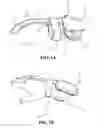 Fig. 02 - Joint movement detection device and system for coordinating motor output with manual wheelchair propulsion