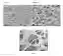 Fig. 07 - Beta sheet tapes ribbons in tissue engineering