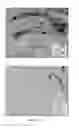 Fig. 16 - Antibodies to amyloid beta