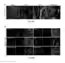 Fig. 22 - METHODS AND COMPOSITIONS FOR MODULATION OF OLFML3 MEDIATED ANGIOGENESIS