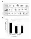 Fig. 28 - METHODS AND COMPOSITIONS FOR MODULATION OF OLFML3 MEDIATED ANGIOGENESIS
