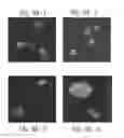 Fig. 09 - COMPOSITIONS AND METHODS FOR TREATMENT OF DRUG RESISTANT MULTIPLE MYELOMA