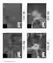 Fig. 03 - COMPOSITIONS AND METHODS FOR GENERATING NEURAL CREST STEM CELLS AND SENSORY NEURONS