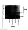 Fig. 07 - Method for obtaining antigen-specific human antibodies by in vitro immunisation