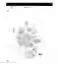 Fig. 08 - Method for inducing pluripotent stem cells to differentiate into ventricular myocytes in vitro