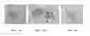 Fig. 02 - Method for culturing a subpopulation of circulating epithelial tumour cells from a body fluid