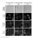 Fig. 24 - METHOD FOR REPROGRAMMING OF HUMAN DENTAL PULP CELL USING OCT4 AND SOX2 AND USE THEREOF