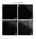Fig. 32 - METHOD FOR REPROGRAMMING OF HUMAN DENTAL PULP CELL USING OCT4 AND SOX2 AND USE THEREOF