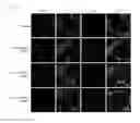 Fig. 41 - METHOD FOR REPROGRAMMING OF HUMAN DENTAL PULP CELL USING OCT4 AND SOX2 AND USE THEREOF