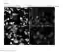 Fig. 02 - Pneumovirus compositions and methods for using the same