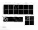 Fig. 07 - CD133 aptamers for detection of cancer stem cells