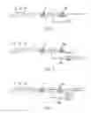Fig. 02 - METHOD OF PRODUCING SILICON-CONTAINING ALUMINUM ALLOY INGOT