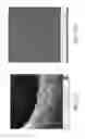 Fig. 35 - Methods of fabricating pillared graphene nanostructures