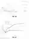 Fig. 04 - Methods and apparatuses for electroplating nickel using sulfur-free nickel anodes