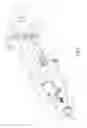 Fig. 04 - Transmission device of electronic lock