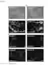Fig. 06 - Tissue sample preparation, and MALDI MS imaging thereof
