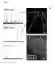 Fig. 08 - Tissue sample preparation, and MALDI MS imaging thereof
